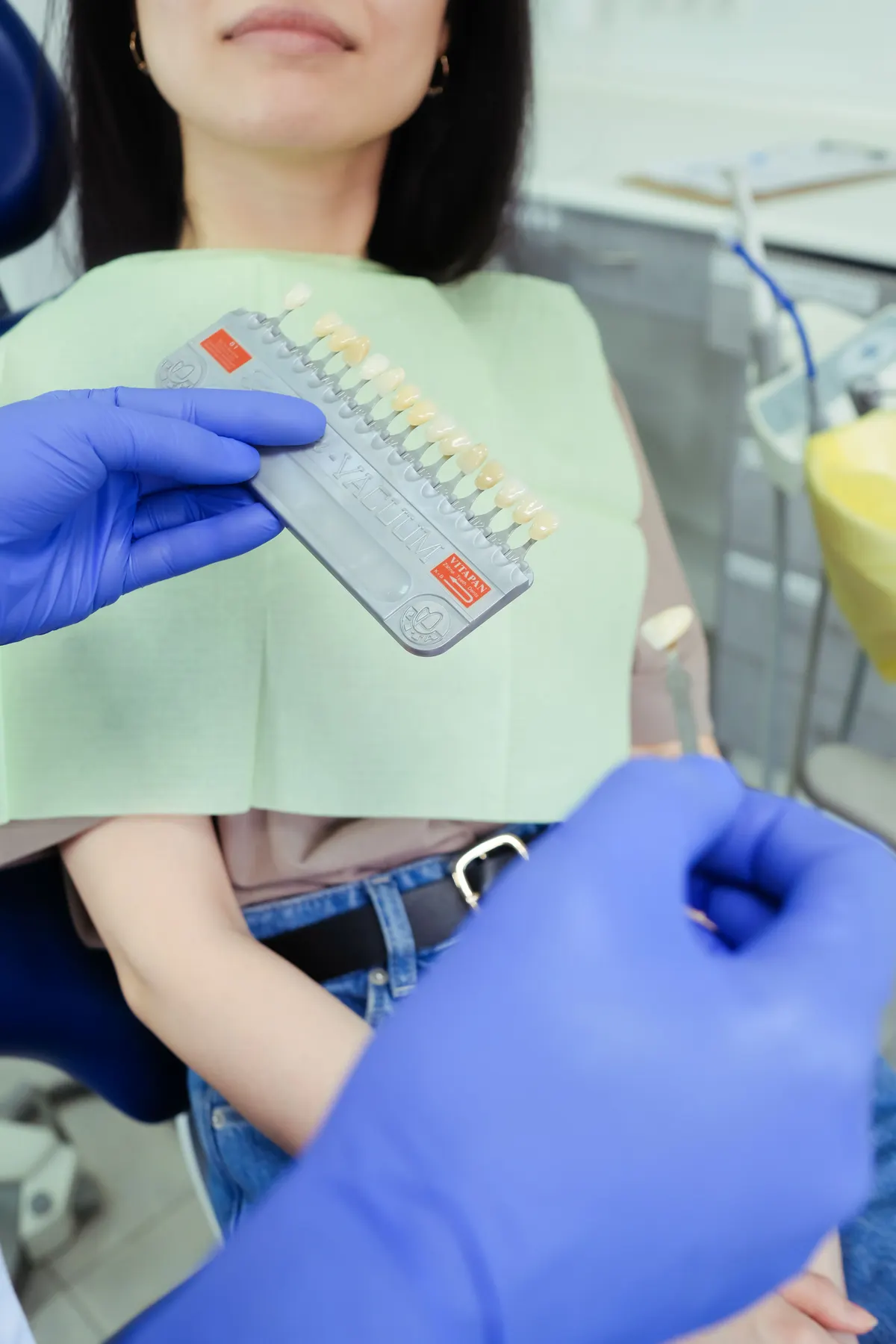Guía de color dental en consulta — imagen ilustrativa